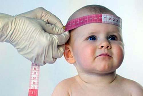 Ministério da Saúde confirma 1.709 casos de microcefalia