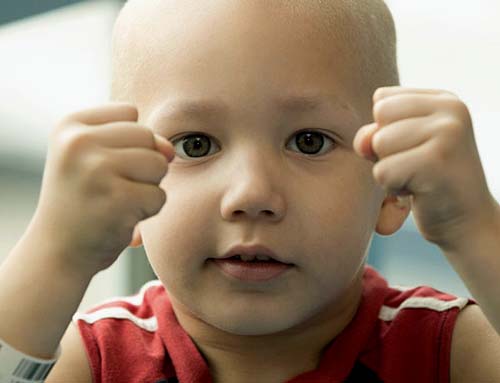 Importância do diagnóstico precoce de câncer em crianças e adolescentes
