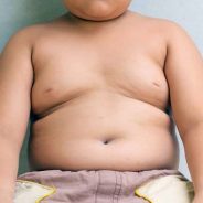 Prevenindo a obesidade infantil